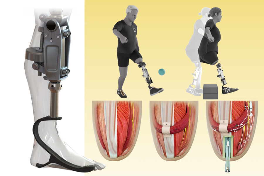 MIT’s New Bionic Knee Feels Like Part of the Body, Not Just a Tool